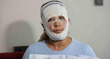 Prenses cilt bakımı kâbusu!